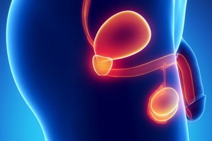 rais-data-saude-cancer-de-prostata-próstata_comp