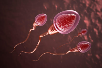 Dr. Felipe Ladeira Varicocele e Infertilidade Masculina
