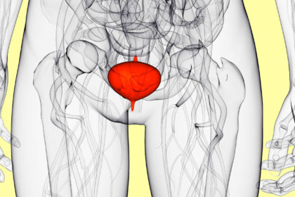 Dr. Felipe Ladeira obstrução urologica