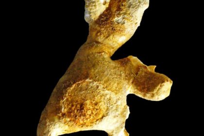 cálculo coraliforme dr felipe ladeira