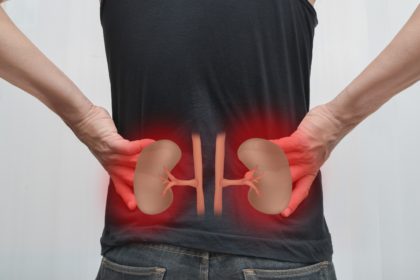 Cisto Renal Dr. Felipe Ladeira