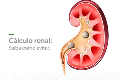 calculo-renal-como-evitar-dr-felipe-ladeira-urologista-teofilo-otoni