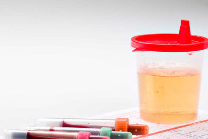 sangue-na-urina-dr-felipe-ladeira-urologista-em-teofilo-otoni